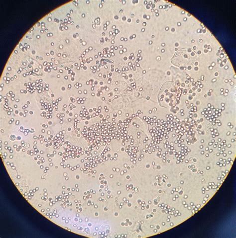 Budding Yeast Under Microscope 40x Micropedia