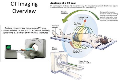 Positron emission tomography (pet) scans are a type of imaging test your doctor uses to identify possible diseases at the cellular level. CT Scan - CAT Scan, Machine, Uses, Prep, Side Effects