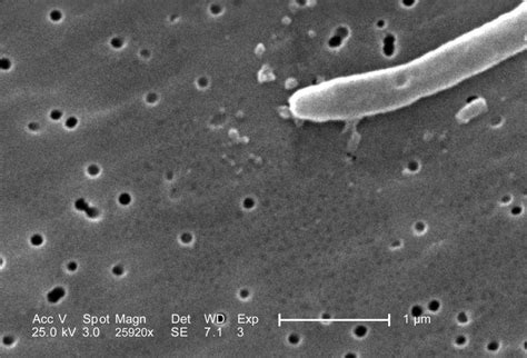 Free Picture Gram Negative Escherichia Coli Bacterium Cell