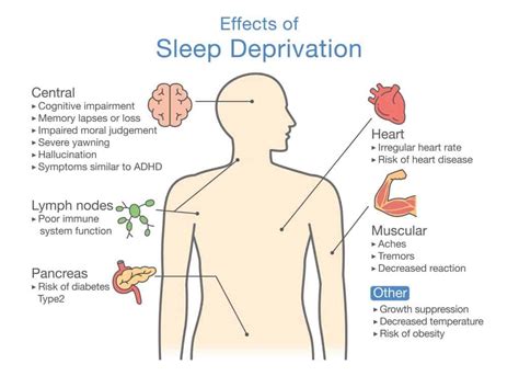 How Sleep Affects Mental Health Expert Guide On Sleep Problems And Mental Illness Lully Sleep