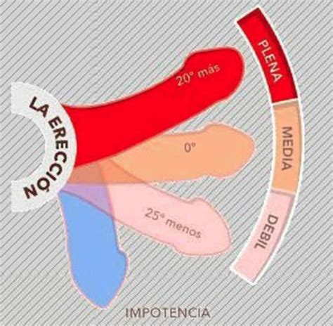 Uro Andrologia Peru Problemas De Ereccion Intratables Los Implantes