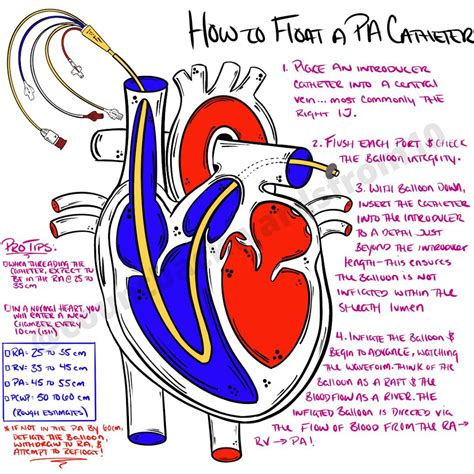 The Pulmonary Arterial Catheter Onestopnursing Emergency Room Nurse Ep