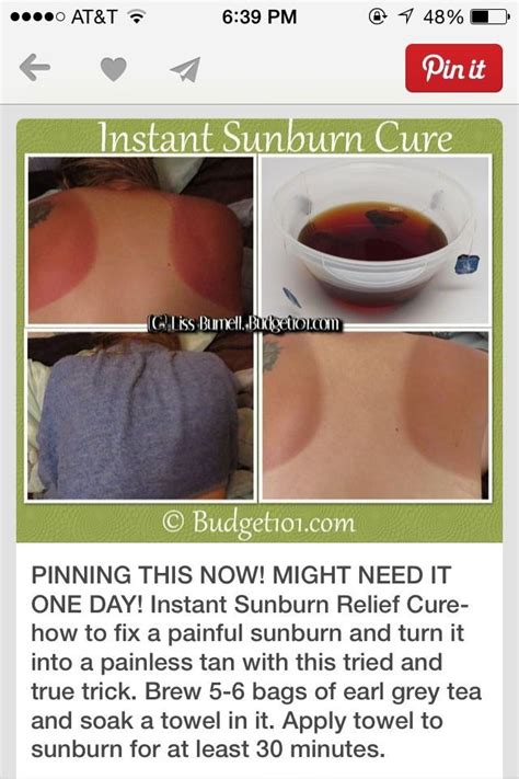 Efashionmaker Com Cure For Sunburn Sunburn Relief Sunburn