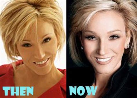 Paula White Plastic Surgery Before And After Photos Lovely Surgery Celebrity Before And