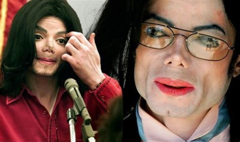 Michael Jackson Died ‘underweight And Covered In Hidden Cuts And