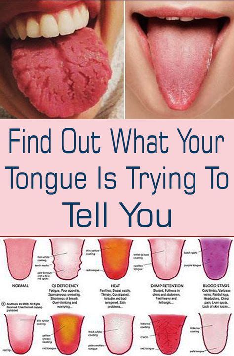 Find Out What Your Tongue Is Trying To Tell You Avec Images Remede