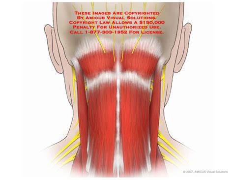 AMICUS Illustration Of Amicus Anatomy Cervical Neck Posterior Nerves