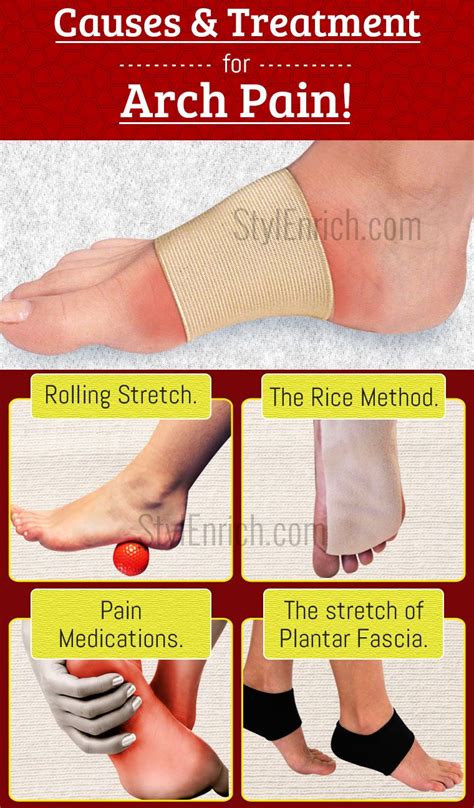 Foot Arch Pain Causes And Treatment In Foot Pain
