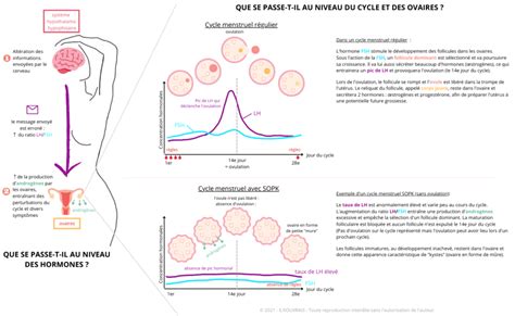 Syndrome Des Ovaires Polykystiques Comprendre La Pathologie