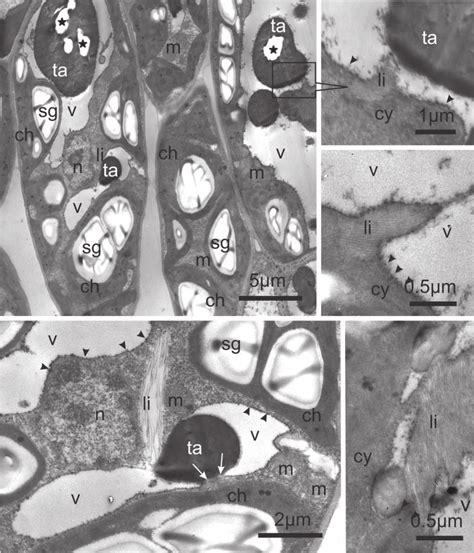 Transmission Electron Micrographs Of Palisade Parenchyma Cells A