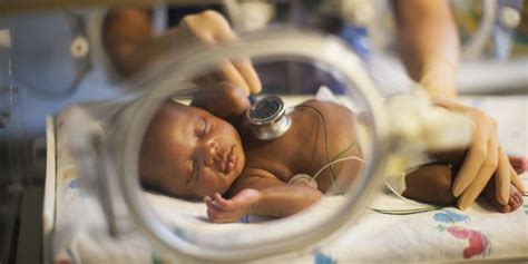 The Reality Of Premature Birth Swhr