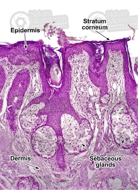 Man Sebaceous Gland Vertical Section 50x Sebaceous Gland Mammals