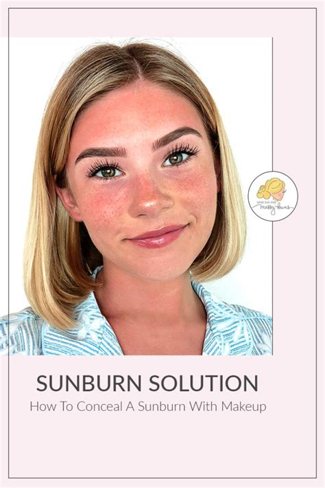 How To Cover Up Sunburn With Makeup Video Tutorial Sand Sun