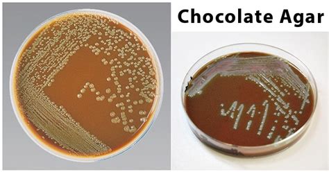 Chocolate Agar Composition Principle Preparation Results Uses