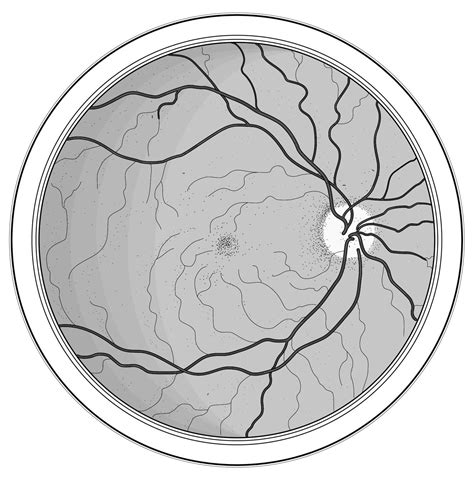 Fundus Line Art American Academy Of Ophthalmology