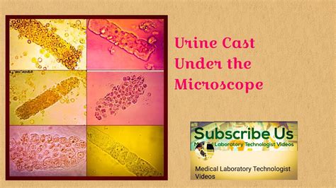 Types Of Urine Infections