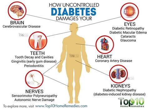 Diabetes Awareness Month July 2019 Telegraph Road Clinic