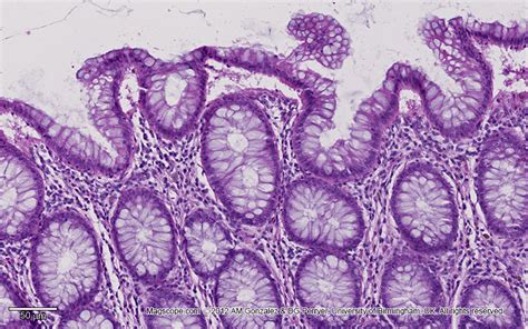 Glandular Tissue Histology