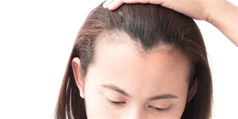 Swollen Forehead Causes Painful Or Not American Celiac
