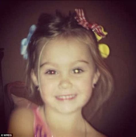Three Year Old Girl Diagnosed With Rare Eye Condition By Picture Her