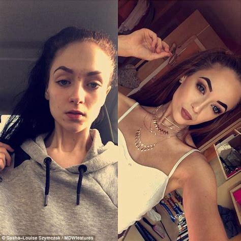 Anorexia Dancer Survived On Calories A Day Daily Mail Online