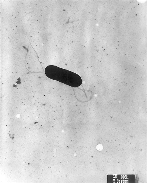 Listeria monocytogenes is a type of bacteria that can cause food poisoning. Listeria - Wikipedia