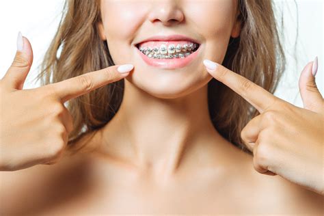 Ortho And Braces In Miami Dental Health Centers In Miami