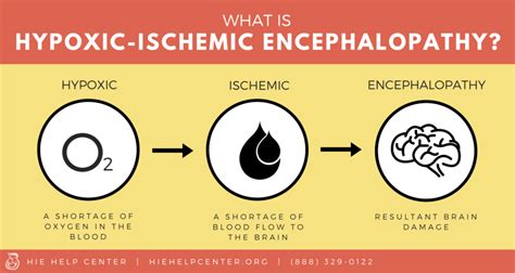 Hypoxic Ischemic Encephalopathy Infographics And Images