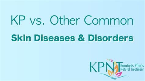 Kp Vs Other Common Skin Diseases And Disorders Video Youtube