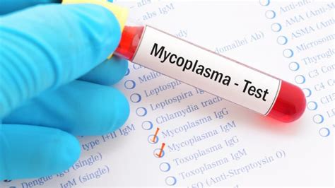 Mycoplasma Mg Treatment And Testing Same Day Doctor