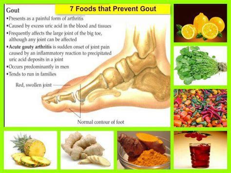 7 Foods That Prevent Gout Daily Inspirations For Healthy Living