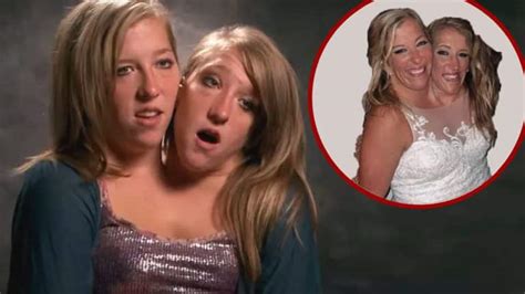 Conjoined Twins Brittany And Abby Hensel Are Married