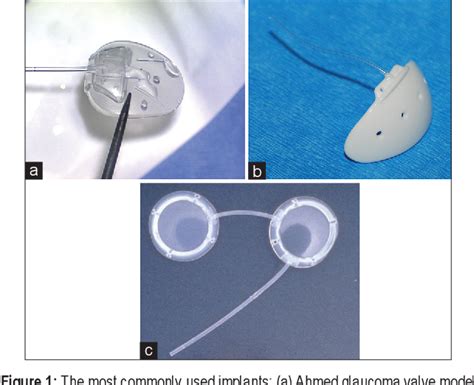 Figure From Aqueous Shunt Implantation In Glaucoma Semantic Scholar
