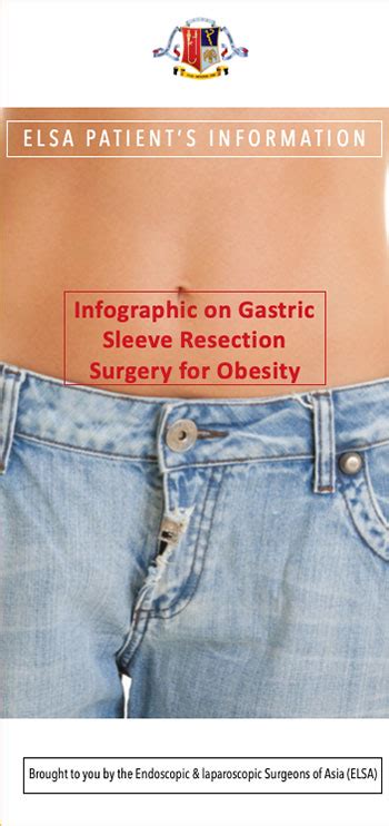 Infographic On Gastric Sleeve Resection Surgery For Obesity Elsa