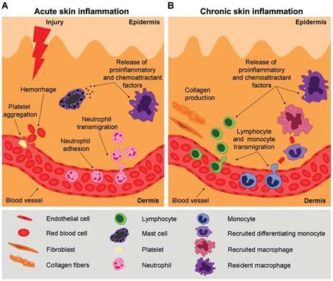 The Cascade Of Acute And Chronic Skin Inflammation A The Initial