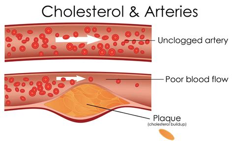 busting myths behind high cholesterol revive active