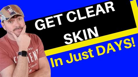 Get Clear Skin In Days 3 Steps To End Acne Chris Gibson Youtube
