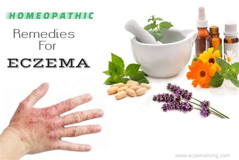 Homeopathy For Eczema Best 7 Eczema Homeopathic Remedies