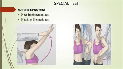 Assessment Of Shoulder