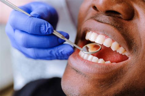 Fewer Patients Receiving Nhs Dental Treatment In The Uk Statistics Reveal Dentistry Online