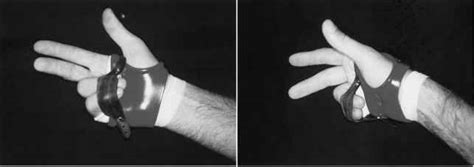Finger Mp Pip Splints Extremity Splinting Mitch Medical
