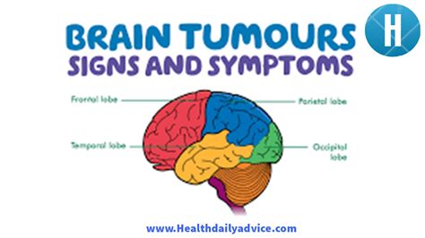 Signs And Symptoms Of A Brain Tumor Health Daily Advice