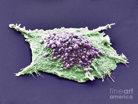 Lung Cancer Cell Photograph By Anne Weston Francis Crick Institute