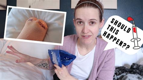 Footless jo 0 views1 days ago. My surgical bandages FELL off?? (*caution* surgical ...