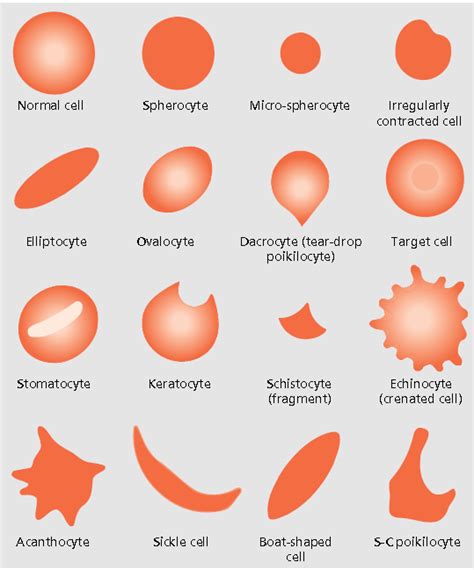 Name That Red Blood Cell Shape Medical Laboratory Science Bcit News