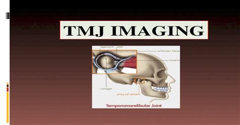 Tmj Imaging Pptx Powerpoint