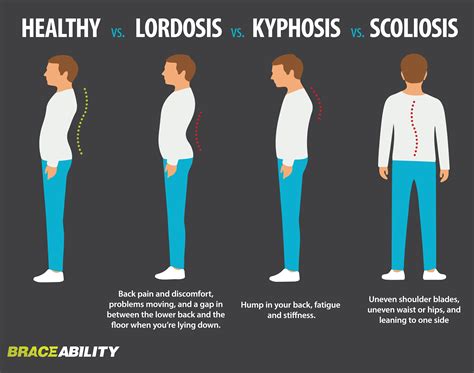 Healthy Vs Lordosis Vs Kyphosis Vs Scoliosis Spine Health