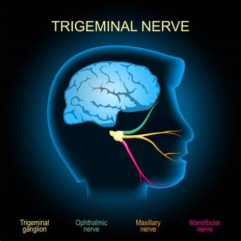 60 Trigeminal Neuralgia Stock Illustrations Royalty Free Vector
