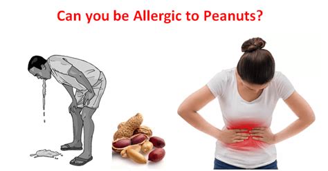 Peanut Allergy Symptoms Treatment And Peanut Allergy Causes Fruits Facts