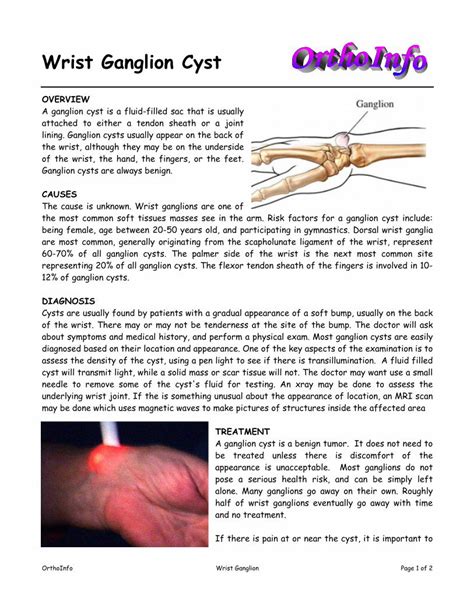 Pdf Wrist Ganglion Cyst Wrist Ganglion Page 1 Of 2 Wrist Ganglion